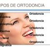 tipos-de-ortodoncia